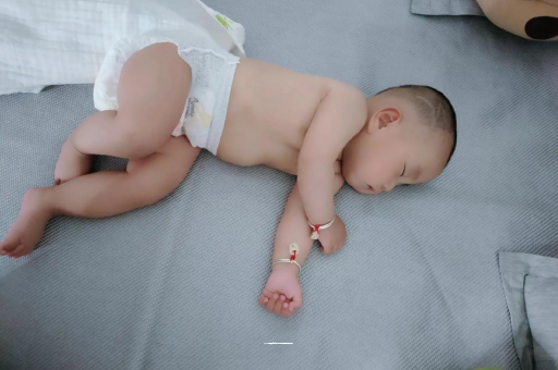 漳州宝宝头上长痱子